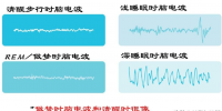 为什么人会在梦里做梦（我想知道为什么人会做梦）